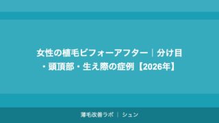 女性の植毛ビフォーアフター｜分け目・頭頂部・生え際の症例【2026年】