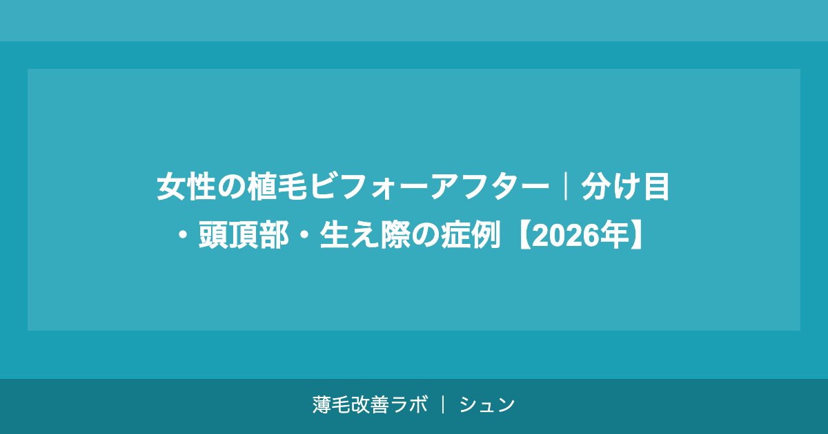 女性の植毛ビフォーアフター｜分け目・頭頂部・生え際の症例【2026年】