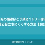 FUT植毛の傷跡はどう残る？ドナー部位の線状瘢痕と目立ちにくくする方法【2026年】