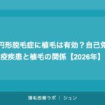 円形脱毛症に植毛は有効？自己免疫疾患と植毛の関係【2026年】