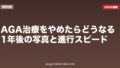 AGA治療をやめたらどうなる？1年後の写真と進行スピード