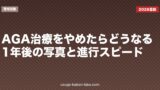 AGA治療をやめたらどうなる？1年後の写真と進行スピード