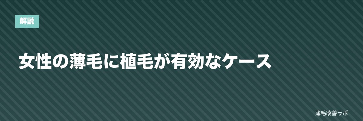 女性の薄毛に植毛が有効なケース | 薄毛改善ラボ