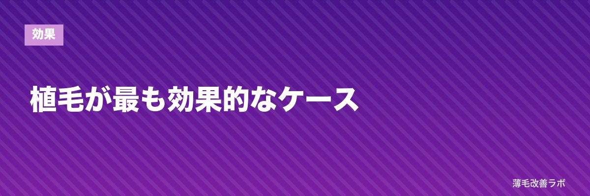 植毛が最も効果的なケース | 薄毛改善ラボ