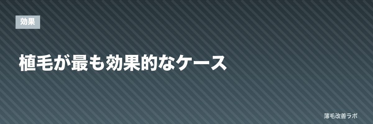 植毛が最も効果的なケース | 薄毛改善ラボ