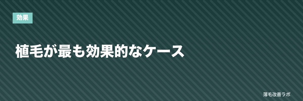 植毛が最も効果的なケース | 薄毛改善ラボ