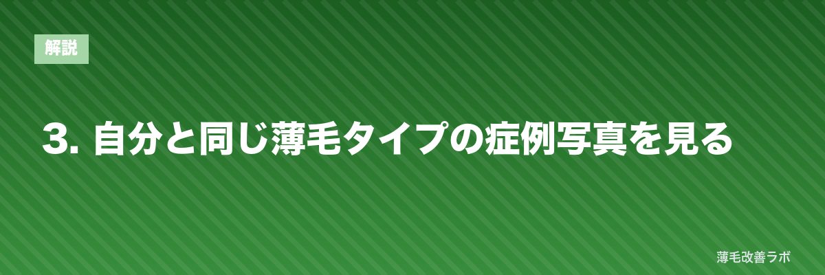 3. 自分と同じ薄毛タイプの症例写真を見る | 薄毛改善ラボ