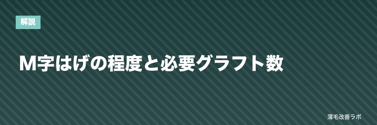 M字はげの程度と必要グラフト数 | 薄毛改善ラボ