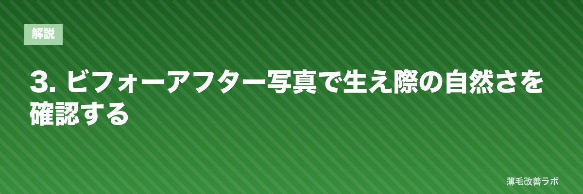 3. ビフォーアフター写真で生え際の自然さを確認する | 薄毛改善ラボ