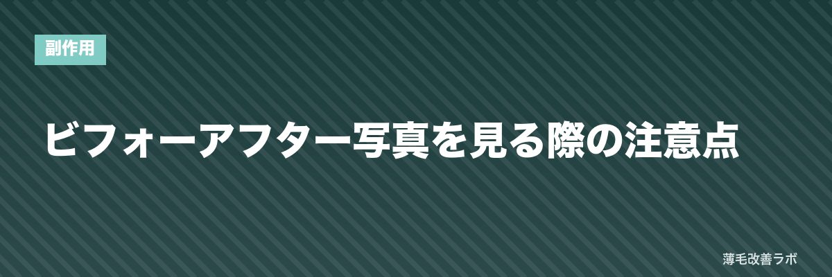 ビフォーアフター写真を見る際の注意点 | 薄毛改善ラボ
