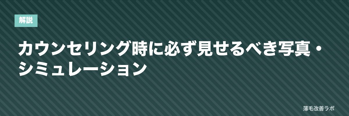 カウンセリング時に必ず見せるべき写真・シミュレーション | 薄毛改善ラボ