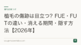 植毛の傷跡は目立つ？FUE・FUTの違い・消える期間・隠す方法【2026年】