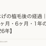 M字はげの植毛後の経過|1ヶ月・3ヶ月・6ヶ月・1年の変化【2026年】