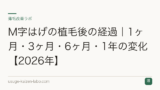 M字はげの植毛後の経過｜1ヶ月・3ヶ月・6ヶ月・1年の変化【2026年】