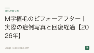 M字植毛のビフォーアフター｜実際の症例写真と回復経過【2026年】