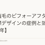 前髪植毛のビフォーアフター｜生え際デザインの症例と効果【2026年】