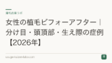 女性の植毛ビフォーアフター｜分け目・頭頂部・生え際の症例【2026年】
