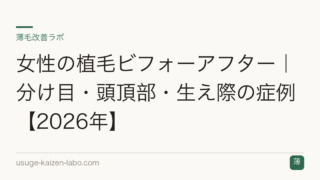 女性の植毛ビフォーアフター｜分け目・頭頂部・生え際の症例【2026年】