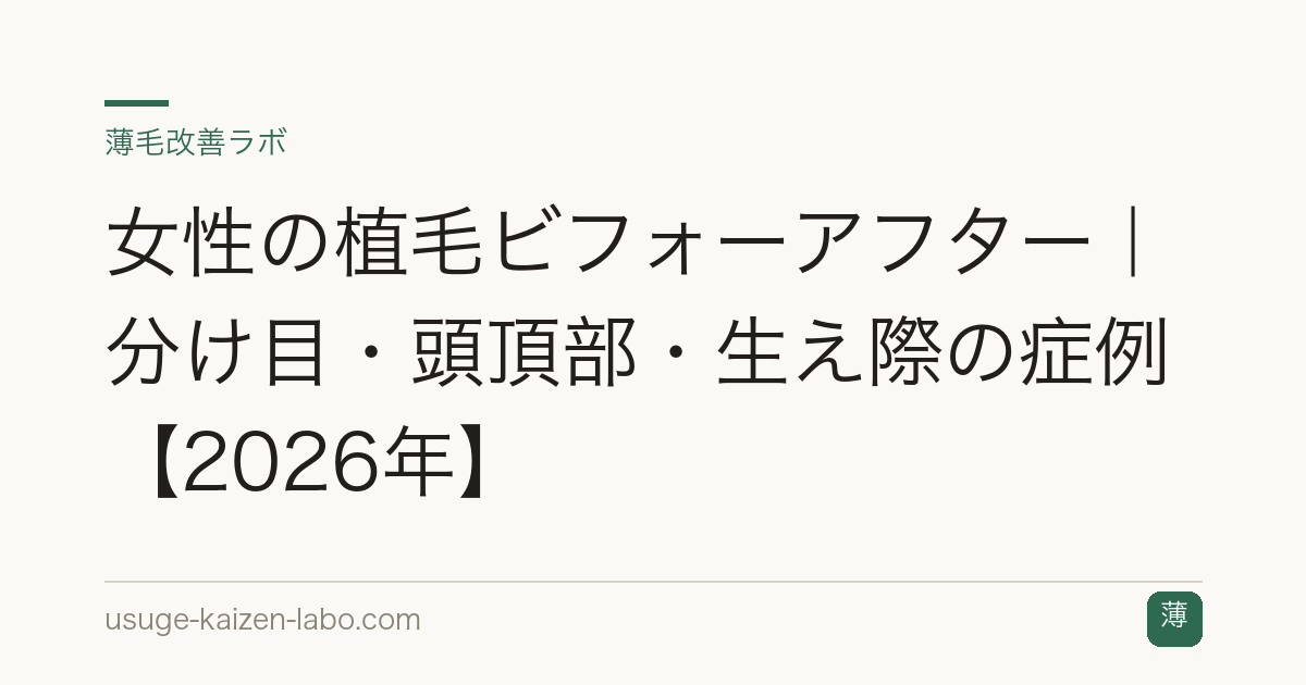 女性の植毛ビフォーアフター｜分け目・頭頂部・生え際の症例【2026年】