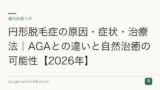 円形脱毛症の原因・症状・治療法｜AGAとの違いと自然治癒の可能性【2026年】
