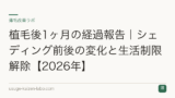 植毛後1ヶ月の経過報告｜シェディング前後の変化と生活制限解除【2026年】