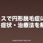 ストレスで円形脱毛症になる?原因・症状・治療法を解説