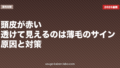頭皮が赤い・透けて見えるのは薄毛のサイン?原因と対策