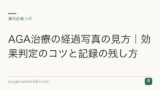 AGA治療の経過写真の見方｜効果判定のコツと記録の残し方