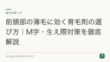 前頭部の薄毛に効く育毛剤の選び方｜M字・生え際対策を徹底解説